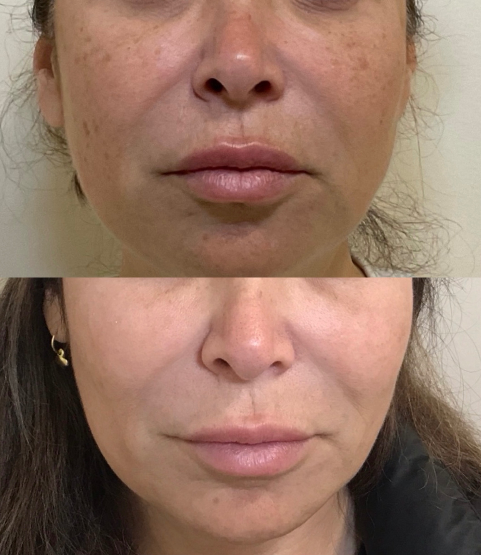 The Distinctive Approach of Eternia Medspa